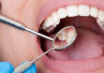 Image-Article6